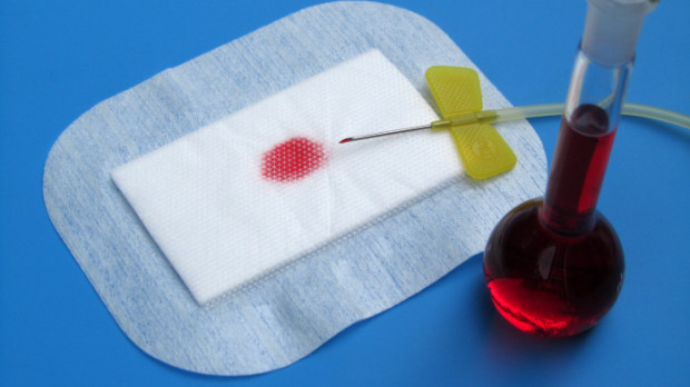 Un chequeo rutinario incluye una analítica de sangre