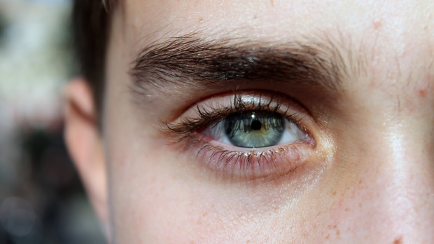 Ojeras