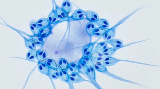 H. salminicola, visto a través de un microscopio