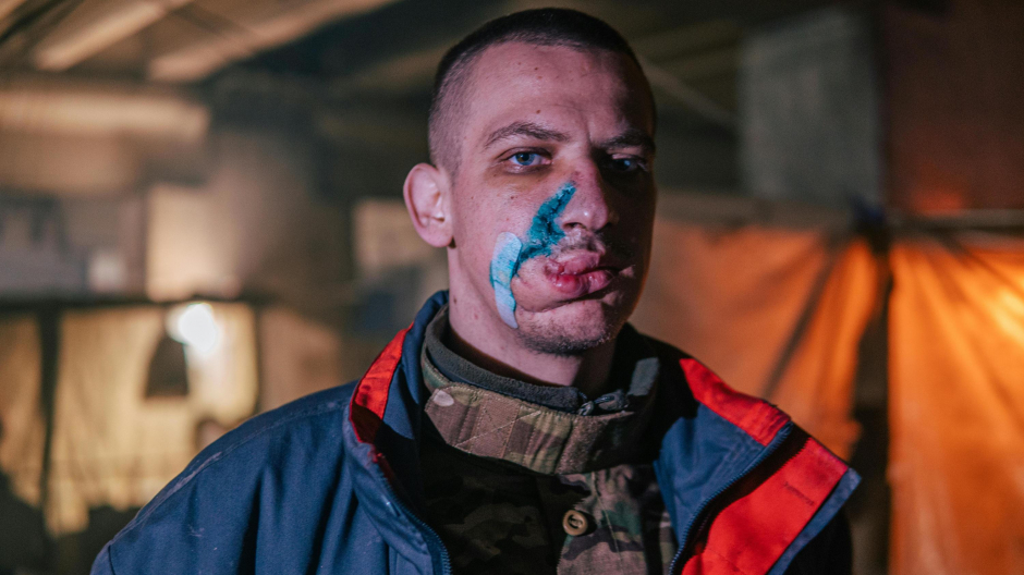 Un soldado muestra las heridas en el rostro. Fotografía tomada en el interior de la sitiada planta de Azovstal, en Mariúpol