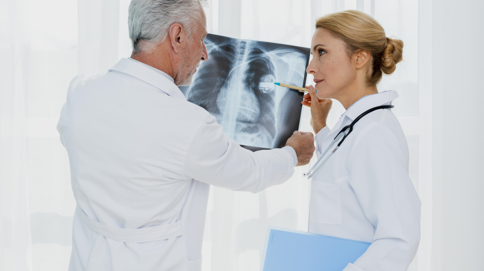 Doctores analizando una radiografía de cáncer de pulmón