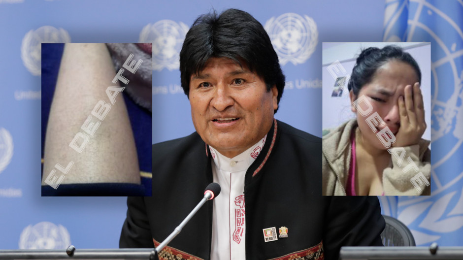 El expresidente Evo Morales junto a una de sus víctimas