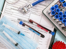 salud-y-bienestar/salud/20260226/analisis-sangre-puede-predecir-quien-vivira-anos-segun-estudio-cientifico_389150