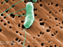 sociedad/20260730/investigadora-explica-riesgo-tiene-contraer-bacteria-carnivora_445381