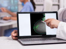 sociedad/20260822/estudio-muestra-resultados-prometedores-tratamiento-quimioterapia-cancer-mama-metastasico_451470