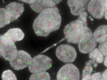 sociedad/20260918/estudian-combinacion-farmacos-cancer-endometrio-alto-riesgo_460111