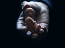 sociedad/20260302/sanchez-pretende-equiparar-aborto-derecho-paro-acceso-cultura-fomento-deporte_390349