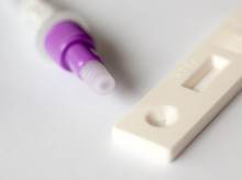 salud-y-bienestar/salud/20260306/sola-gota-saliva-podria-detectar-epilepsia-parkinson-esquizofrenia_392616