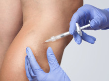 salud-y-bienestar/salud/20260919/otono-buen-momento-tratar-varices_458788