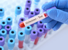 salud-y-bienestar/salud/20261021/busqueda-farmaco-contra-alzheimer-halla-inesperadamente-posible-biomarcador_471888