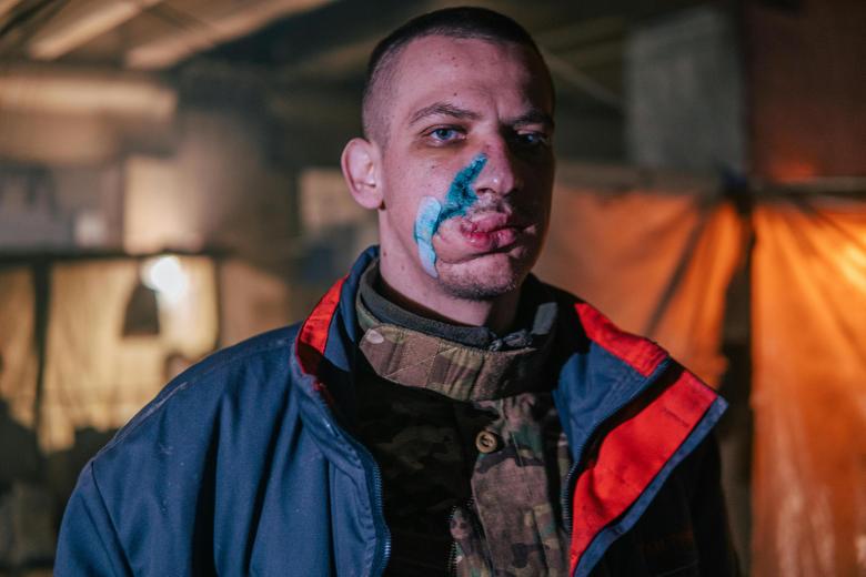 Un soldado muestra las heridas en el rostro. Fotografía tomada en el interior de la sitiada planta de Azovstal, en Mariúpol