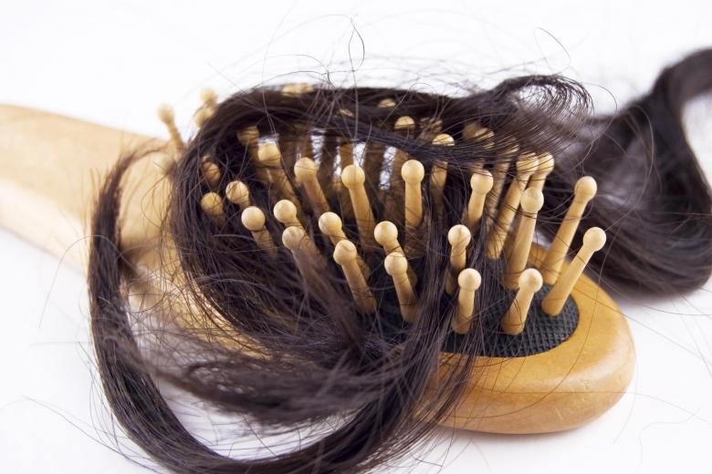 Caída de cabello. Normalmente se han conocido casos de pérdida exagerada de cabello al menos un mes después de sufrir la infección, normalmente por el estrés generado por la enfermedad. Por lo general, este pelo vuelve a crecer con el paso del tiempo.