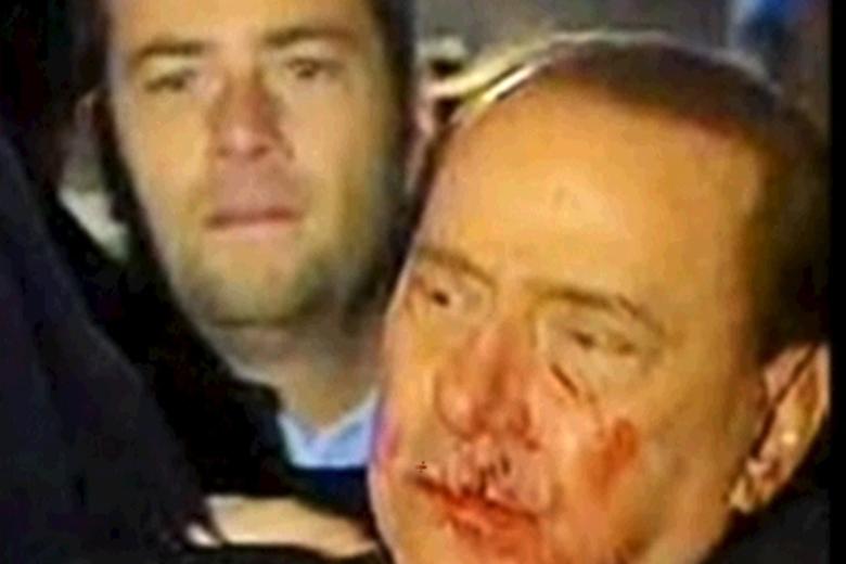 Silvio Berlusconi con el rostro ensangrentado tras recibir un golpe de un hombre después de un acto político en Milán 2009