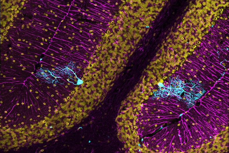 Recordando a Cajal para tratar la neurodegeneración es la foto seleccionada en la modalidad "Año Cajal".

Las células derivadas de la médula ósea suponen una terapia potencial para tratar enfermedades neurodegenerativas. En la imagen vemos una inmunofluorescencia de una sección de cerebelo con dos células de Purkinje fusionadas que expresan GFP en color cian. En amarillo, marcamos la lamina nuclear, que nos permite ver si las células GFP positivas tienen dos núcleos diferentes debido a la fusión. Por último, en magenta, observamos la proteína ácida fibrilar glial (GFAP), expresada por un tipo de glía en el cerebelo. La GFP se distribuye de forma uniforme por toda la célula, permitiéndonos ver las neuronas de Purkinje con todo detalle. Este marcaje nos recuerda a los dibujos de Ramón y Cajal, que ya describió su estructura.