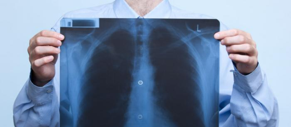Logran detectar infecciones pulmonares tan solo con el análisis del aliento