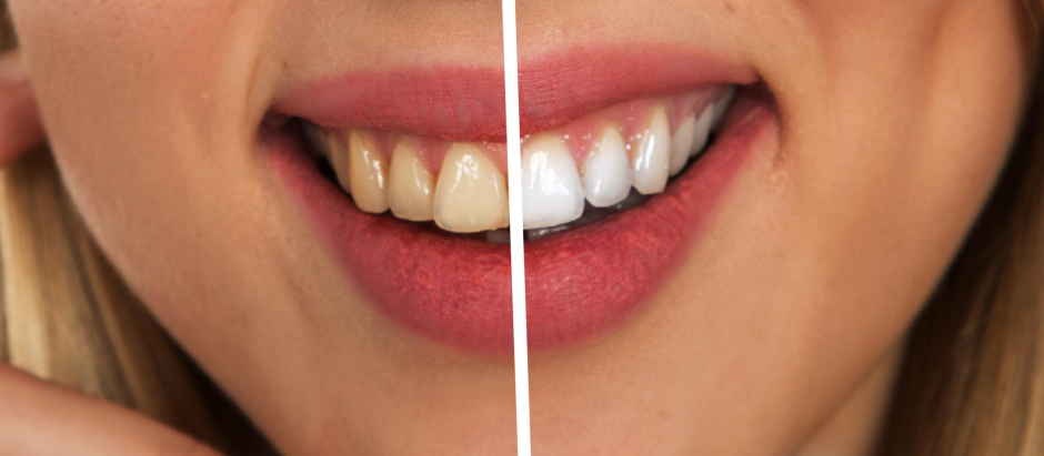Cada vez hay más productos que aseguran que podemos ganar tonos de blancura en nuestros dientes