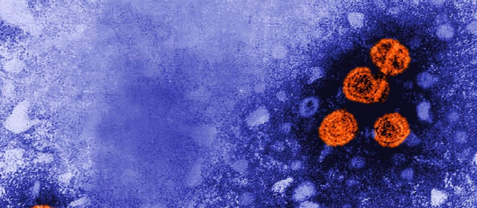 Imagen de transmisión coloreada digitalmente revela la presencia de viriones de la hepatitis B.