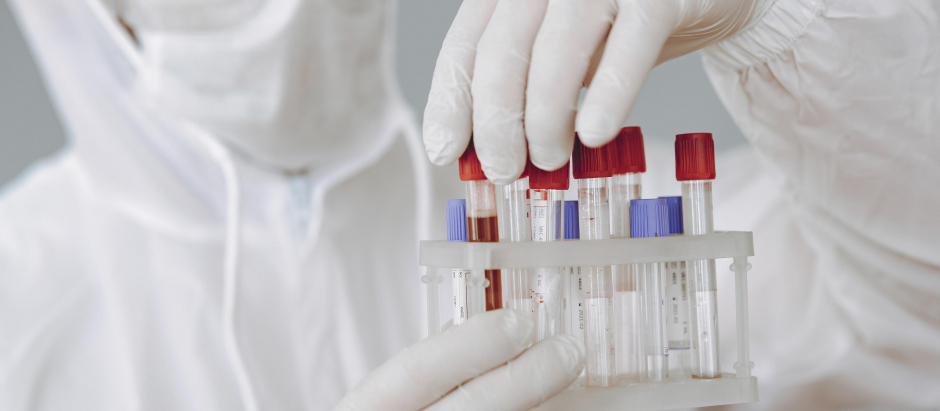 Los autores del estudio recomiendan hacer test de sangre al nacer