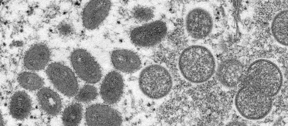 Vista microscópica de la viruela del mono