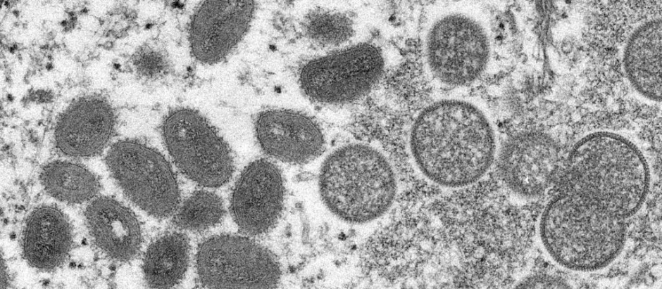Vista microscópica de la viruela del mono