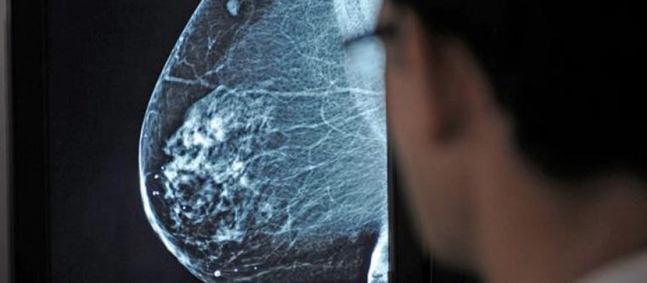 Un médico revisa una mamografía