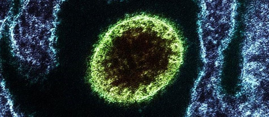 Un henipavirus, a vista de microscopio