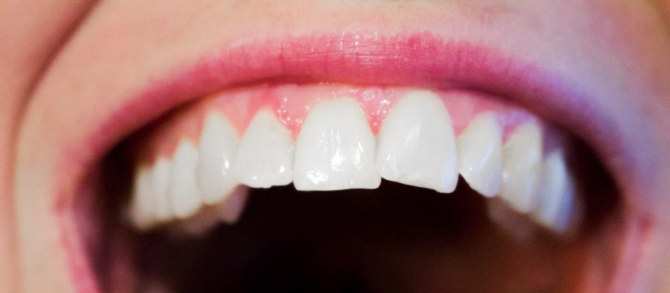 Los dientes no son blancos, su color se acerca más al del marfil