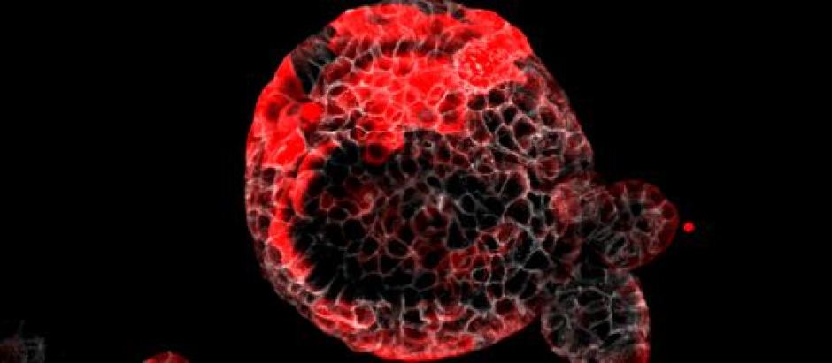 Organoide de cáncer colorrectal con las células residuales responsables de la recaída en rojo.