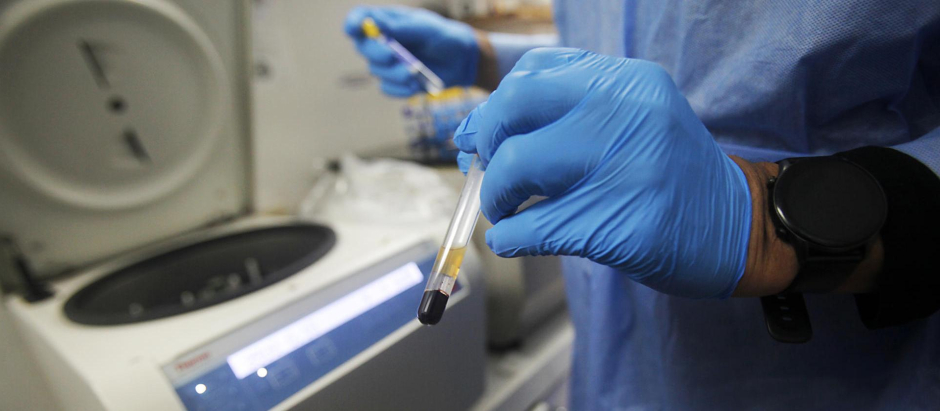 Un trabajador sanitario manipula una muestra para un examen de VIH