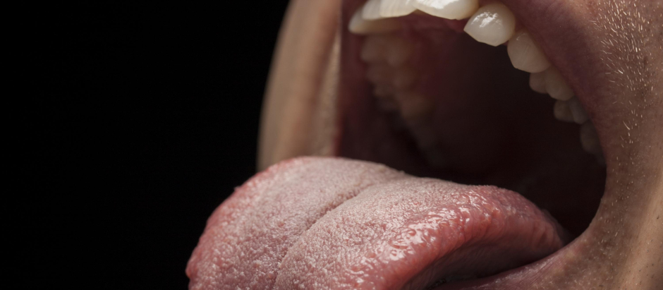 Una úlcera en la boca que no se cura es el síntoma más común