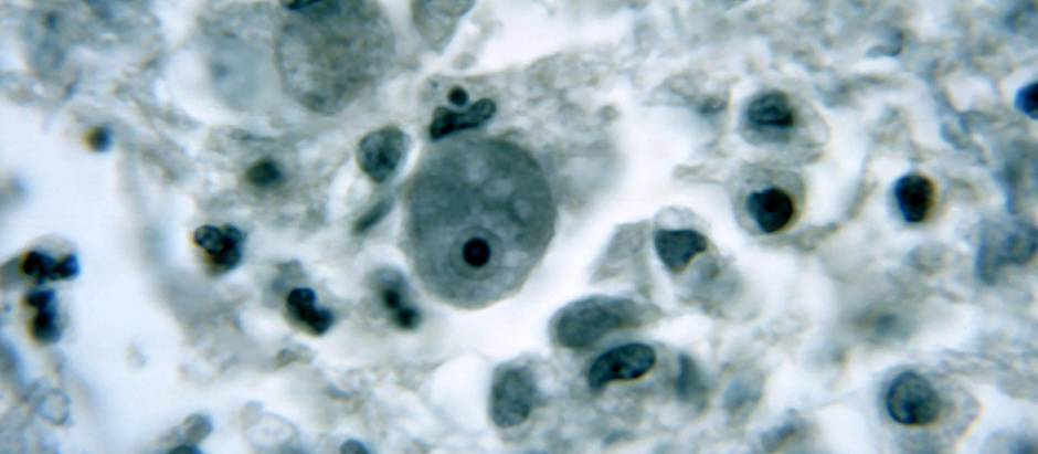 La ameba comecerebros, a vista microscópica