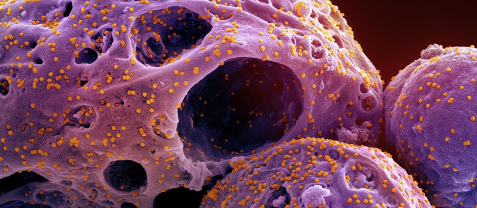 Imagen de células infectadas por ómicron.