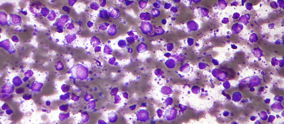 Células linfoma B