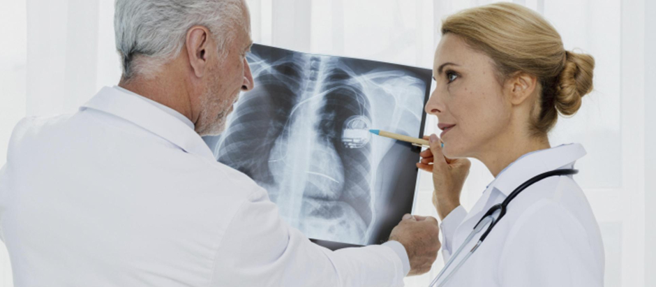 Doctores analizando una radiografía de cáncer de pulmón