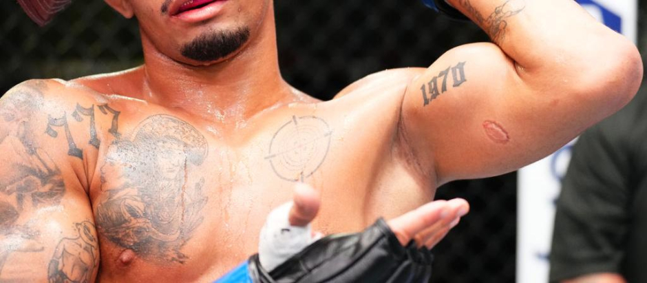 André Lima fue mordido por su compatriota Igor Severino en un combate de la UFC