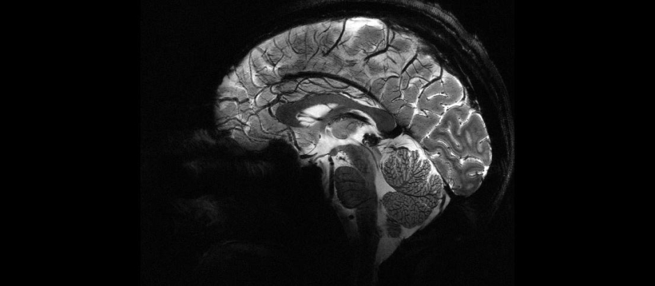 Imagen lateral del cerebro