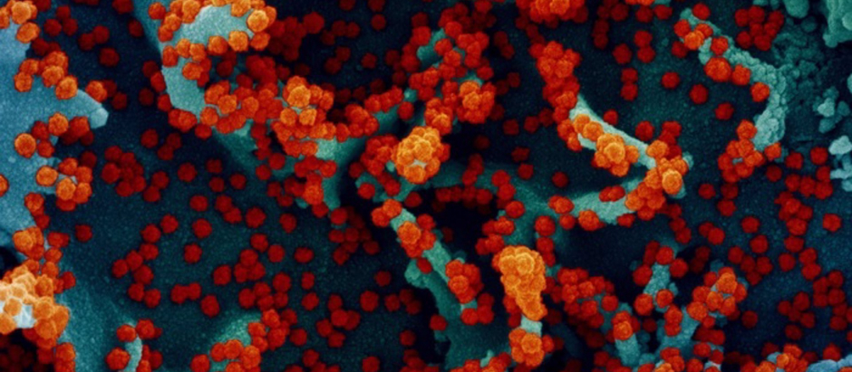 Micrografía electrónica de barrido coloreada de una célula infectada con SARS-CoV-2