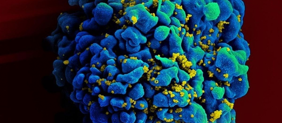 Micrografía de barrido de una célula T H9 infectada por el VIH