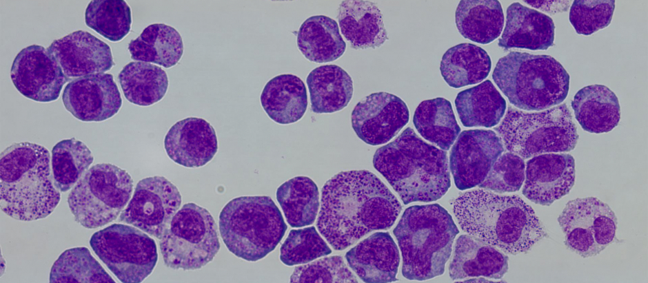 Células madre hematopoyéticas y células proleucémicas en cultivos celulares del estudio
