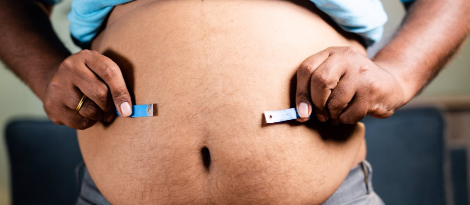 El sobrepeso origina al menos 13 tipos de cáncer y otro tipo de enfermedades
