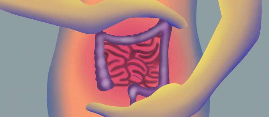 Ilustración cáncer de colon