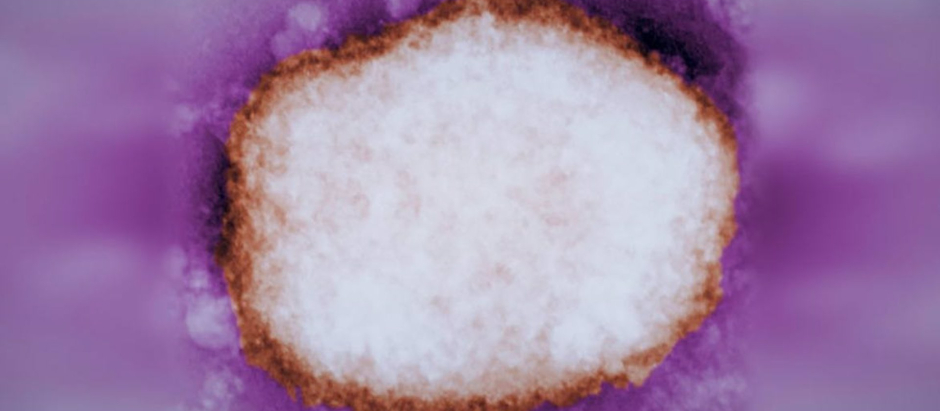 Partícula amplificada del virus de la viruela del mono