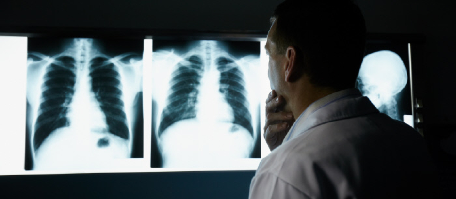 Un médico observa varias radiografías de tórax