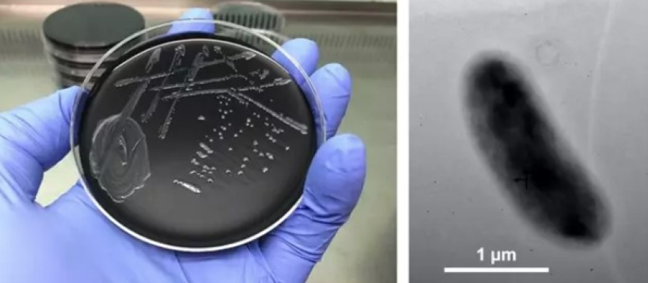 Muestra de la bacteria 'Legionella maioricensis'