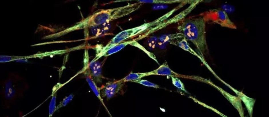 Células de rabdomiosarcoma convertidas en células musculares