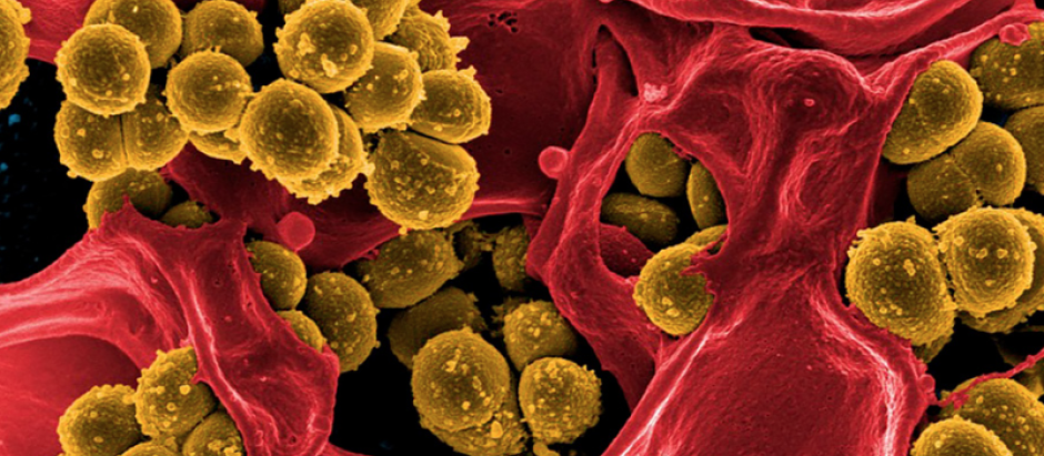 El término superbacterias se aplica a aquellas cepas de bacterias que, a lo largo del tiempo, han ido creando una resistencia a los antibióticos