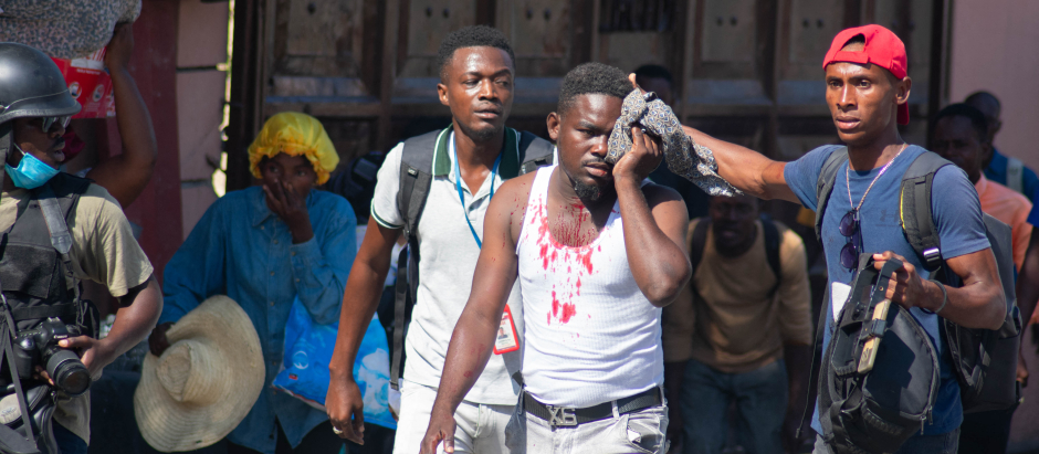 Un periodista herido recibe ayuda después de haber sido alcanzado por un bote de gas lacrimógeno