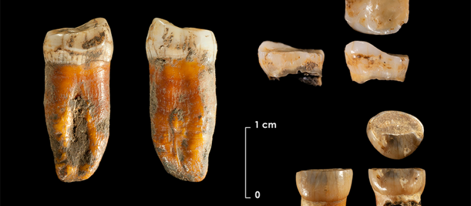 Piezas dentarias descubiertas en Axlor