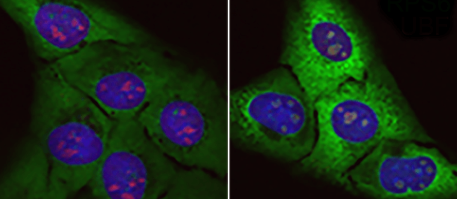 Células normales (i) y células sometidas al efecto de la proteína tóxica (d)