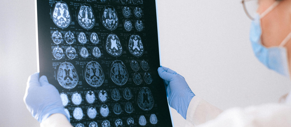 Imágenes del cerebro a través de un TAC